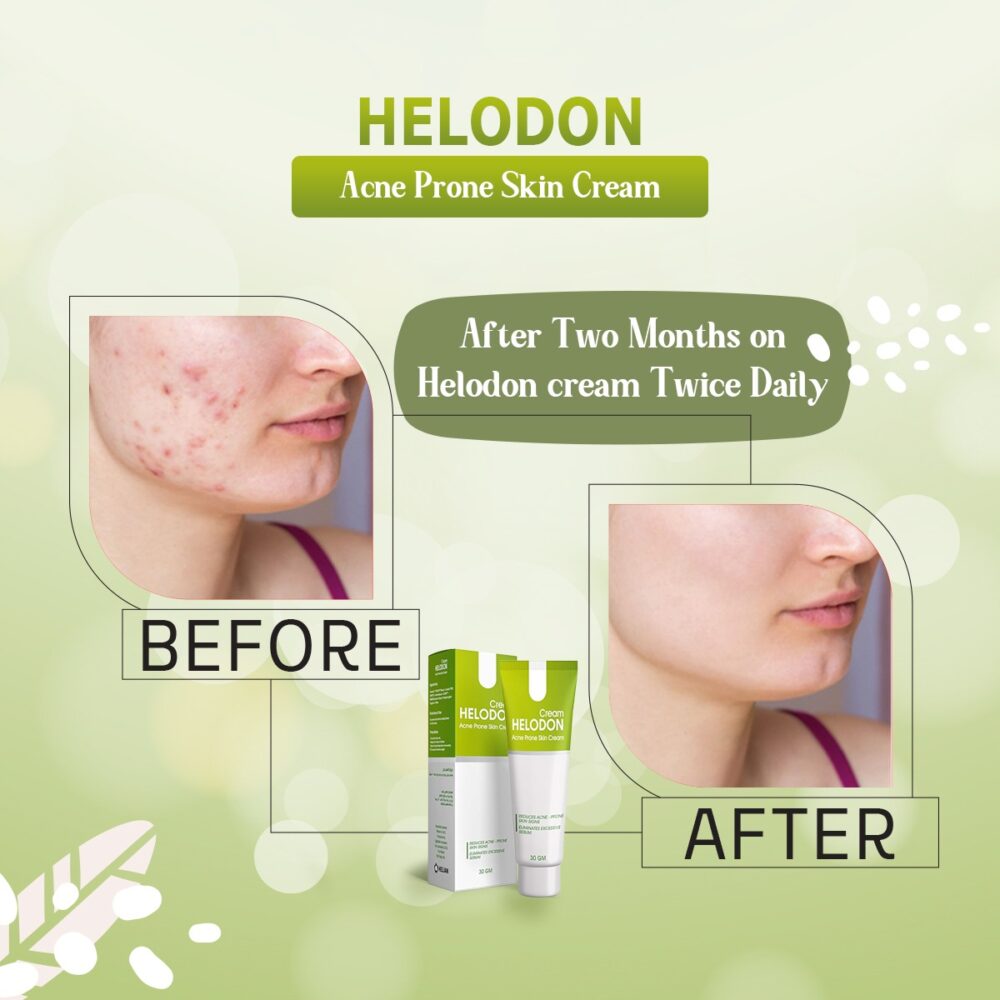 Helodon - Image 2